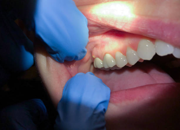 Best Emergency Dental Services for Seniors in Wellston, OH